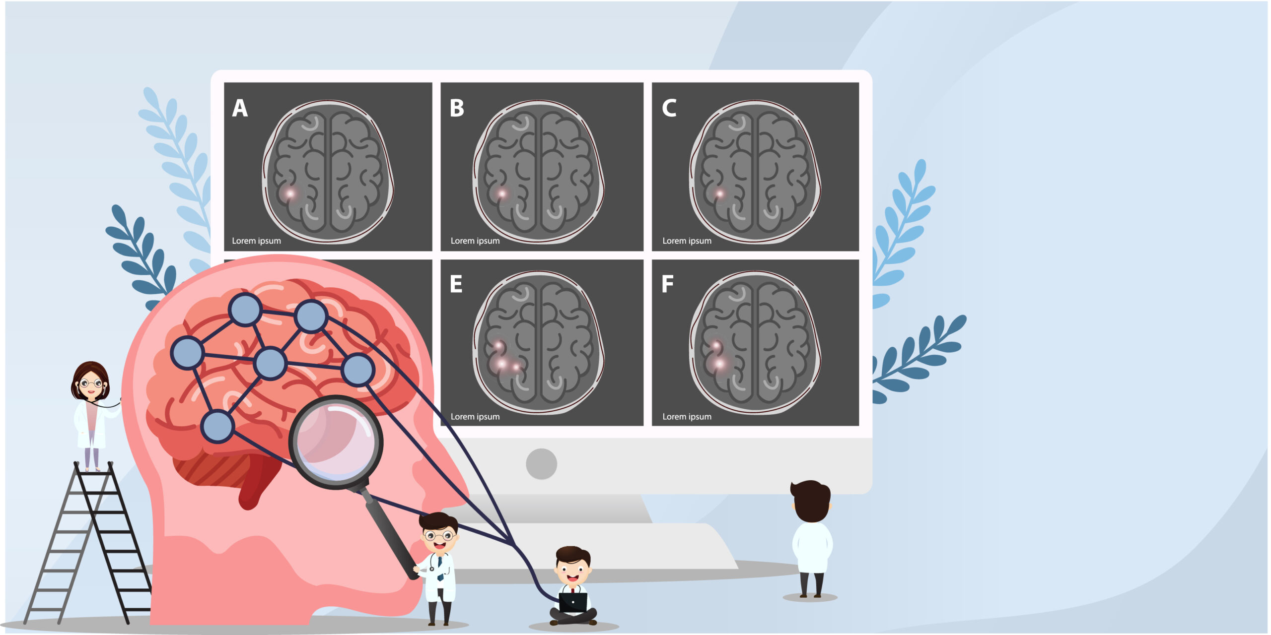 Brain Stroke Therapy at Rebirth Physio